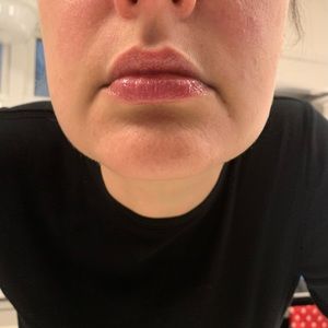 Meet your Posher, Eri